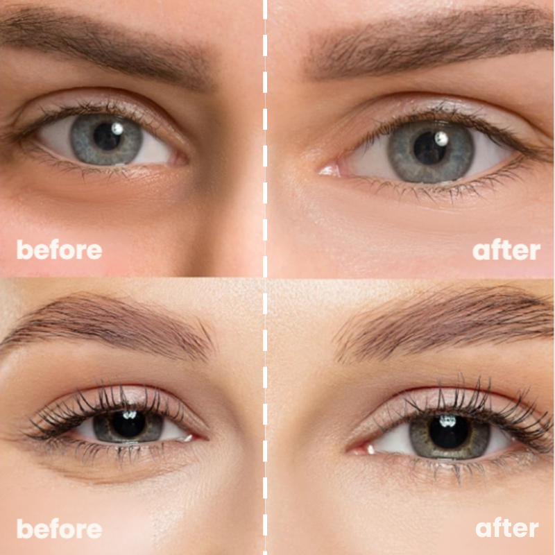 AvoGlow™ Under-Eye Patches