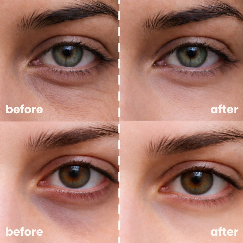 AvoGlow™ Under-Eye Patches